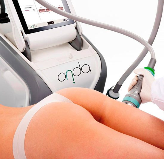 Remodelado de cuerpo