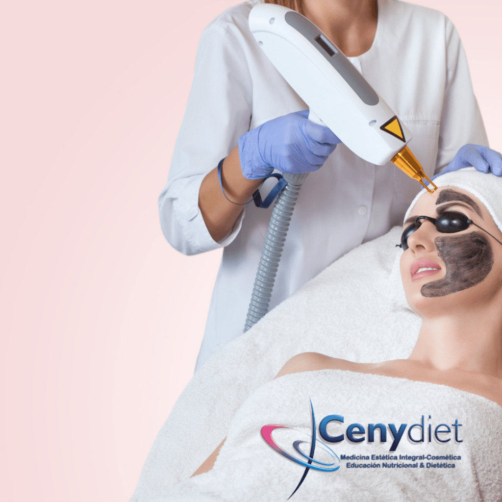 carbon peel-cenydiet