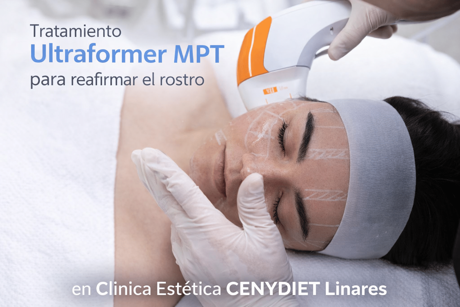 tratamiento ultraformer mpt en linares reafirmar rostro