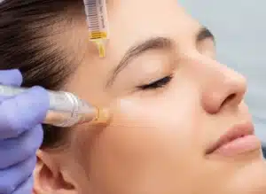 Exosomas faciales en tratamientos estéticos no invasivos en Linares