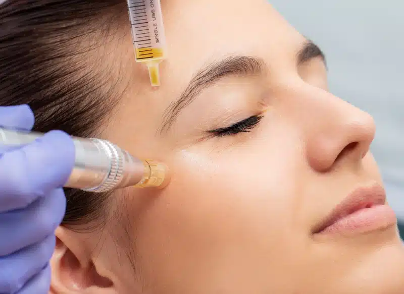 Tratamiento de rejuvenecimiento facial en Jaen para ojeras y mirada cansada en CENYDIET