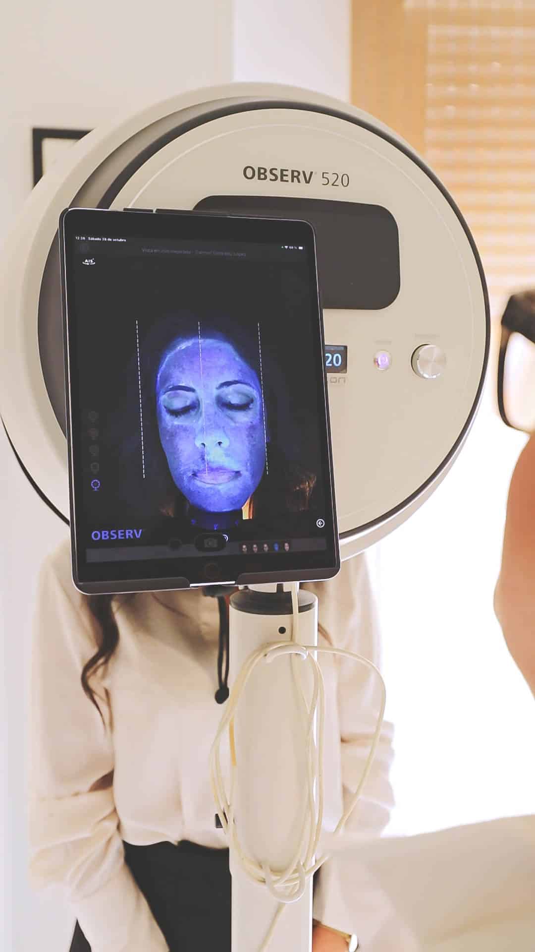 como-tratar-melasma-cenydiet-linares.jpg